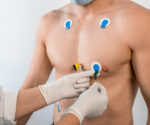 3D-EKG im Rahmen der Cardisiographie